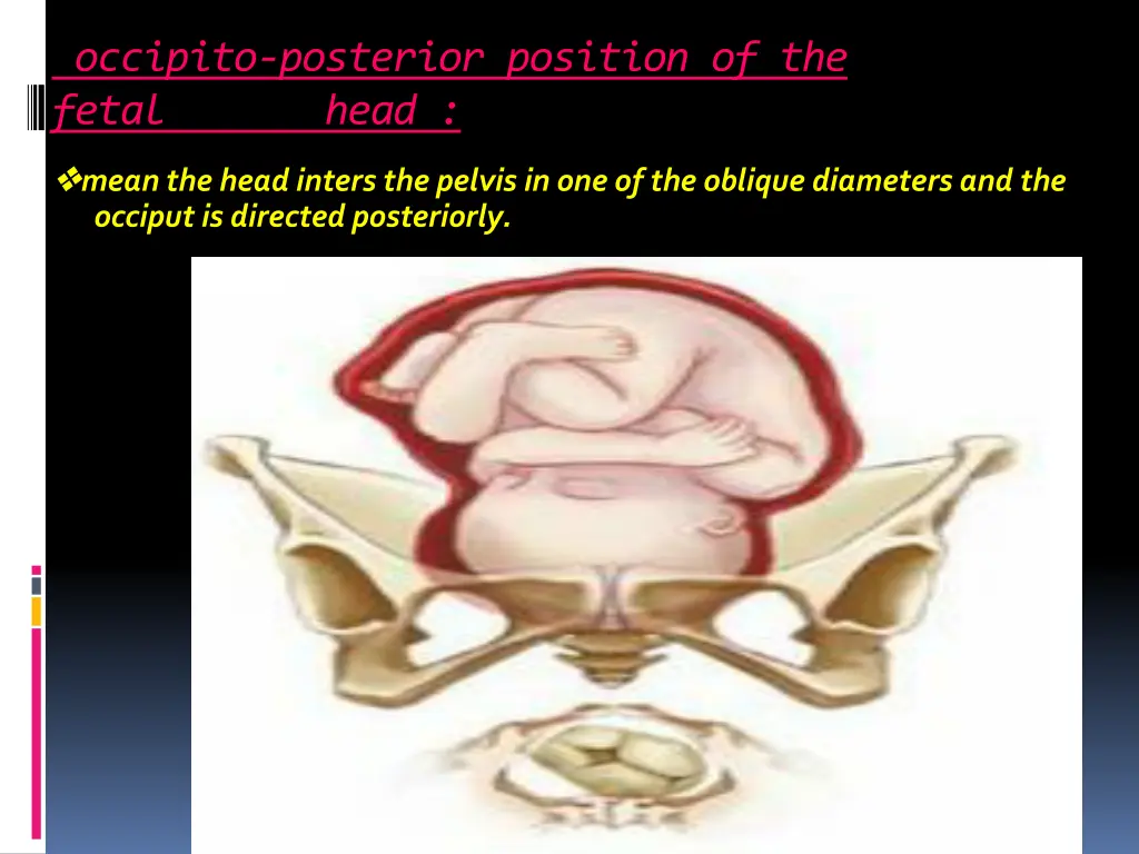 occipito posterior position of the fetal head