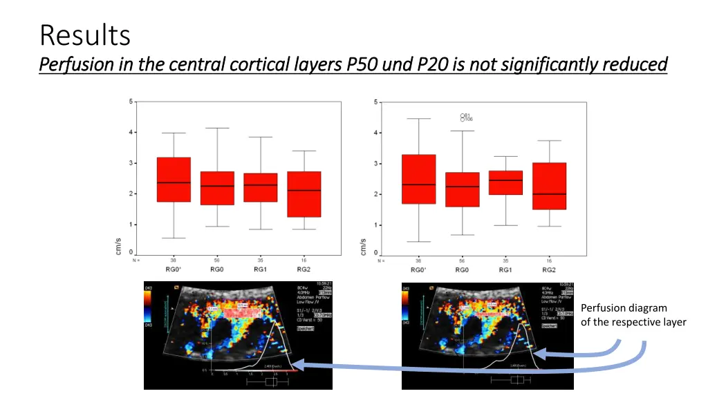 results perfusion in perfusion in the