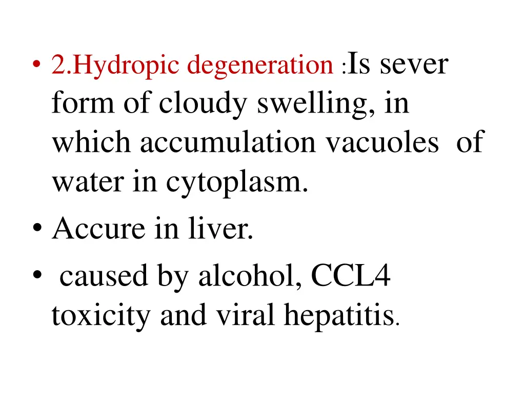 2 hydropic degeneration is sever form of cloudy