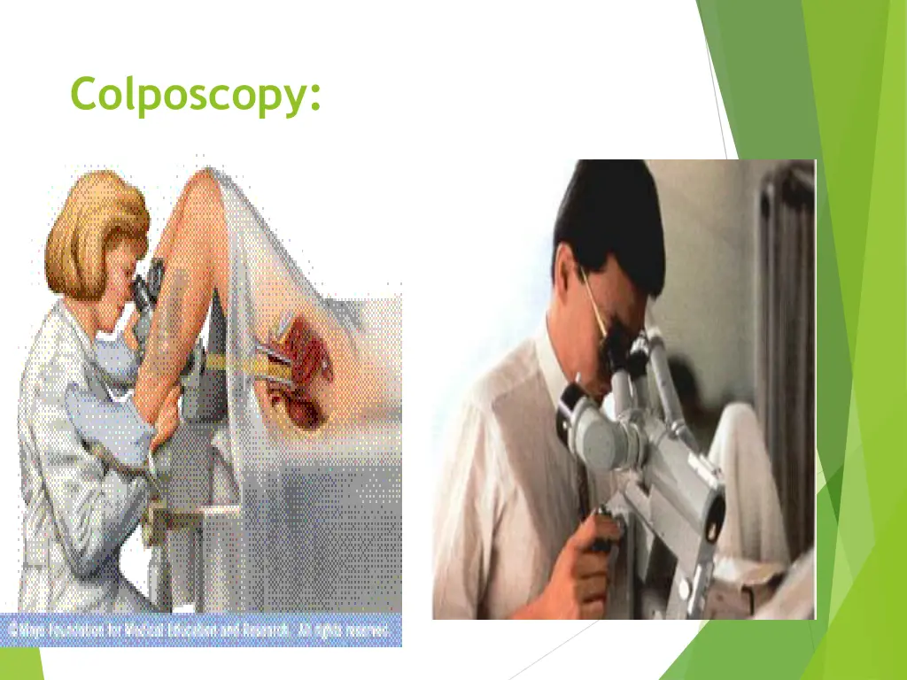 colposcopy 1