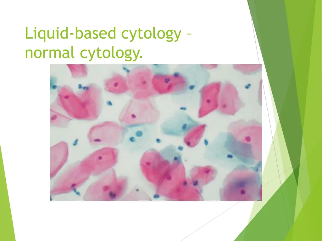 liquid based cytology normal cytology