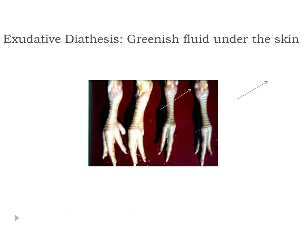 exudative diathesis greenish fluid under the skin