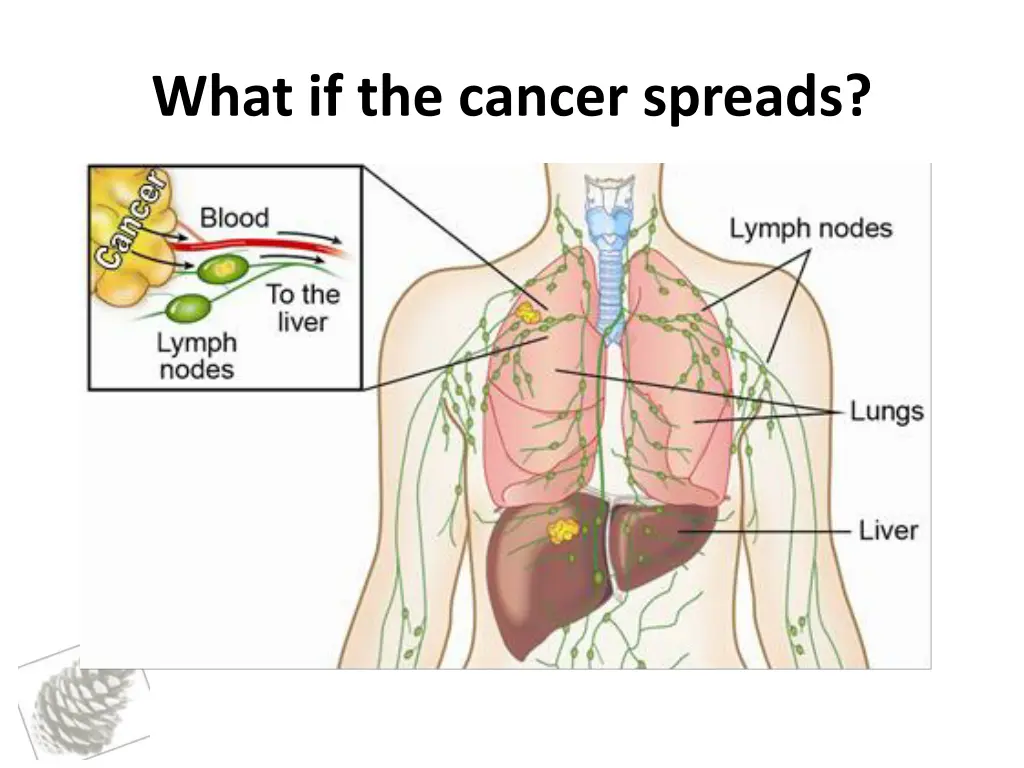 what if the cancer spreads