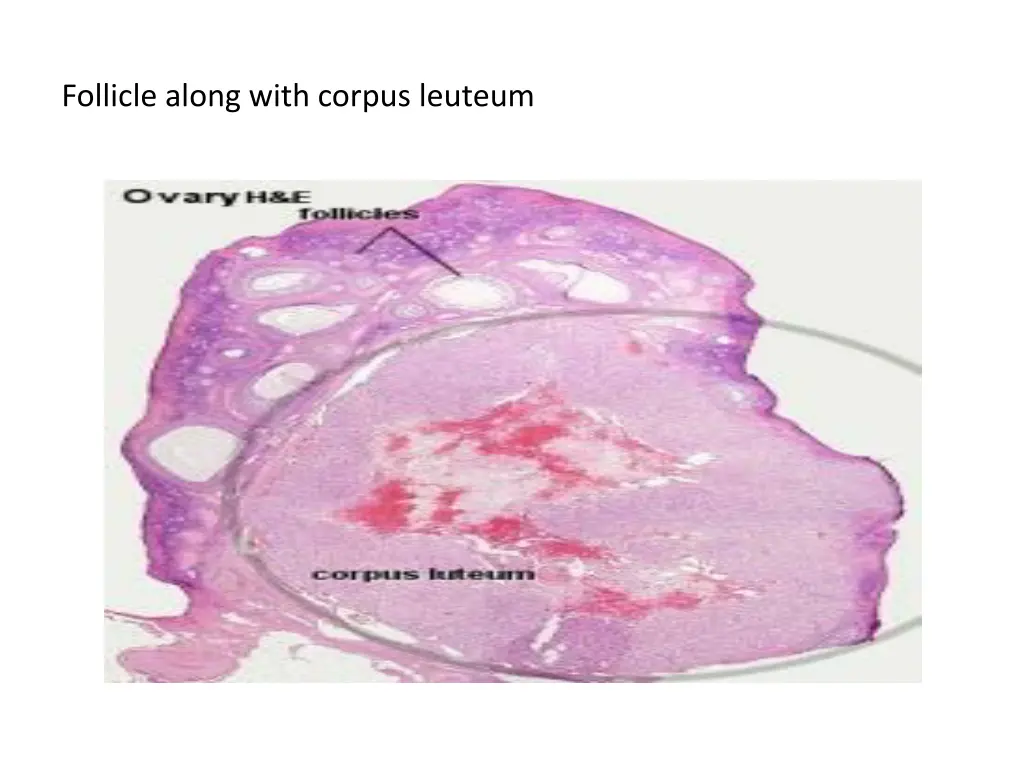 follicle along with corpus leuteum