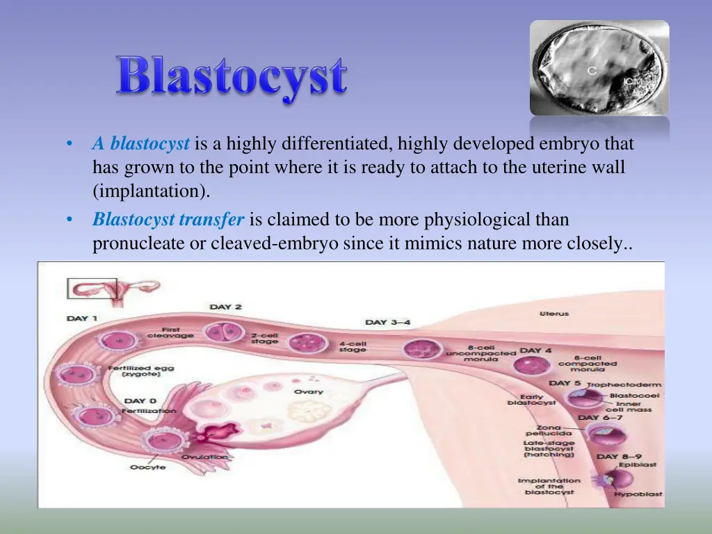 a blastocyst is a highly differentiated highly