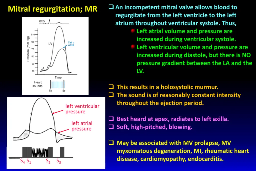 an incompetent mitral valve allows blood