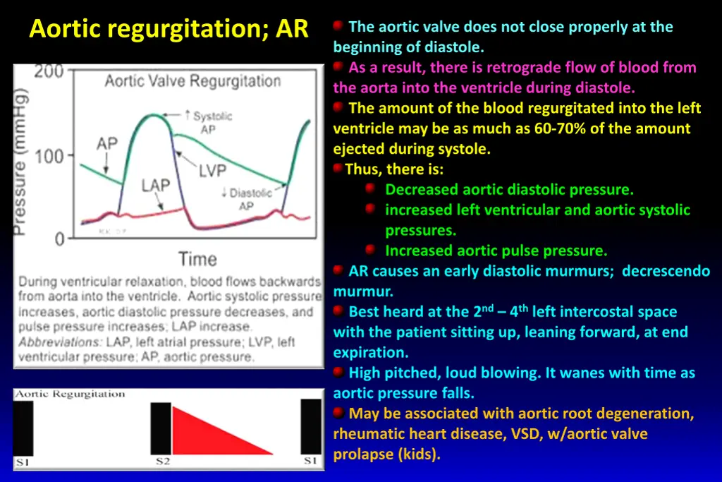 aortic regurgitation ar