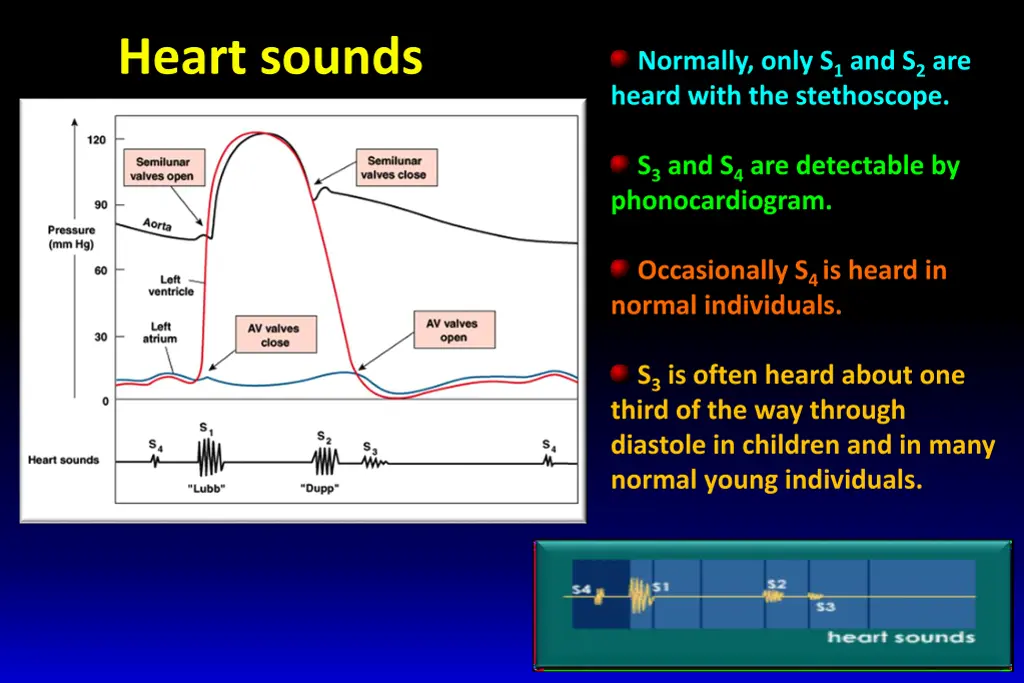 heart sounds