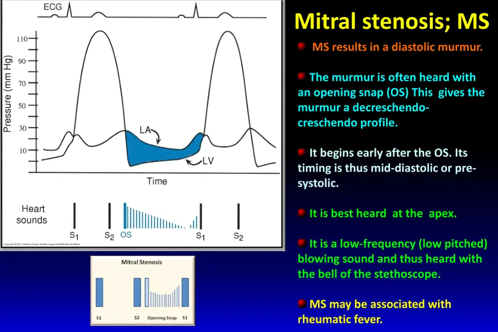 mitral stenosis ms 1