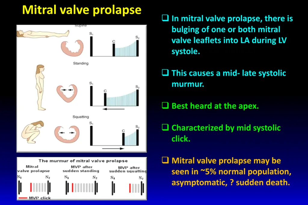 mitral valve prolapse