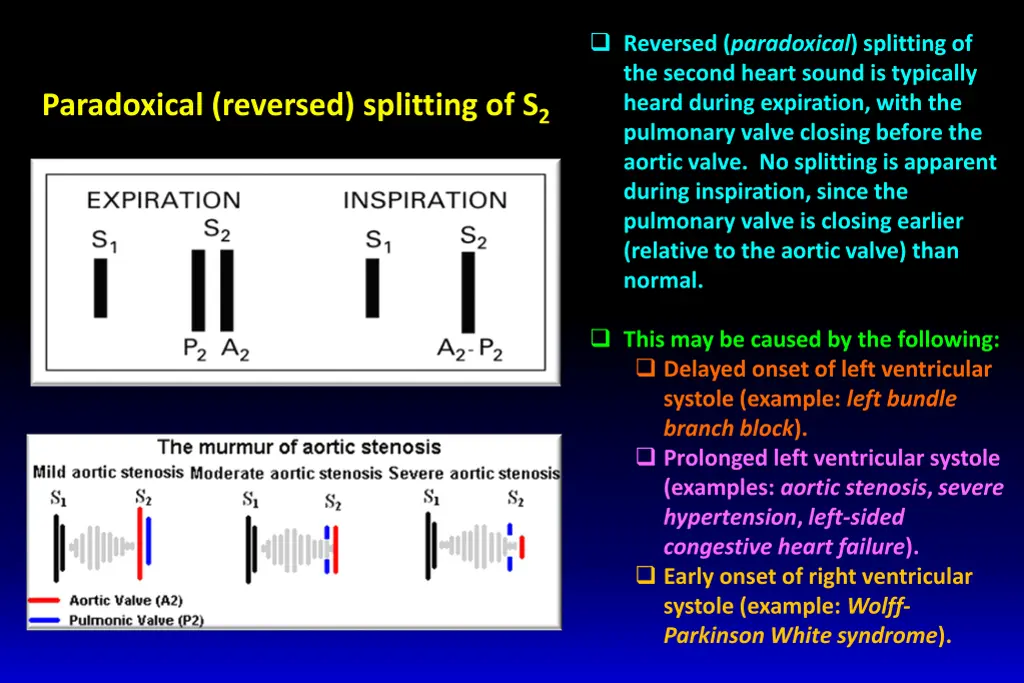 reversed paradoxical splitting of the second