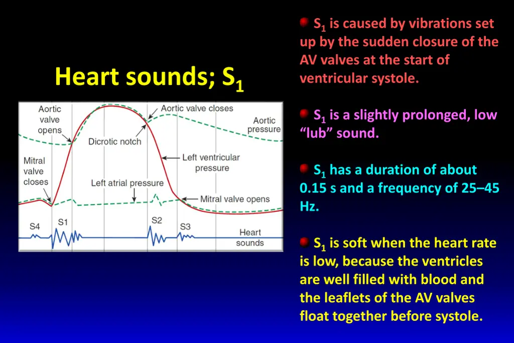 s 1 is caused by vibrations set up by the sudden