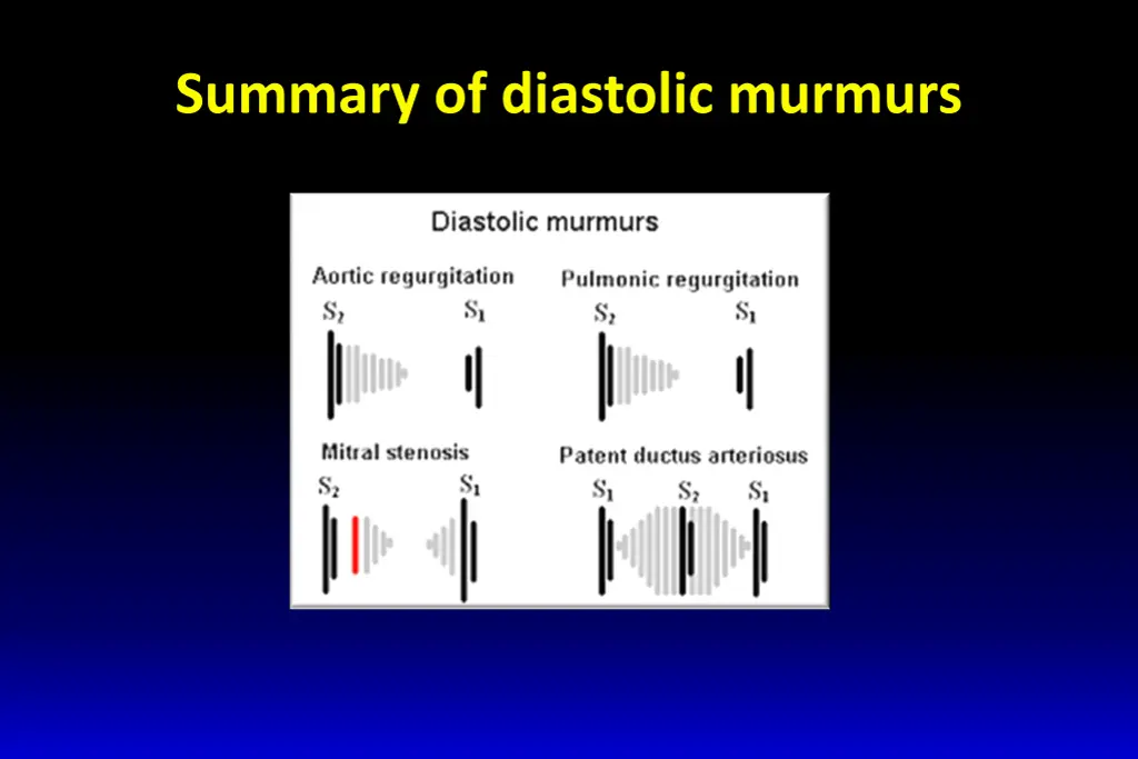 summary of diastolic murmurs