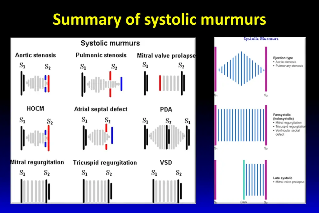 summary of systolic murmurs