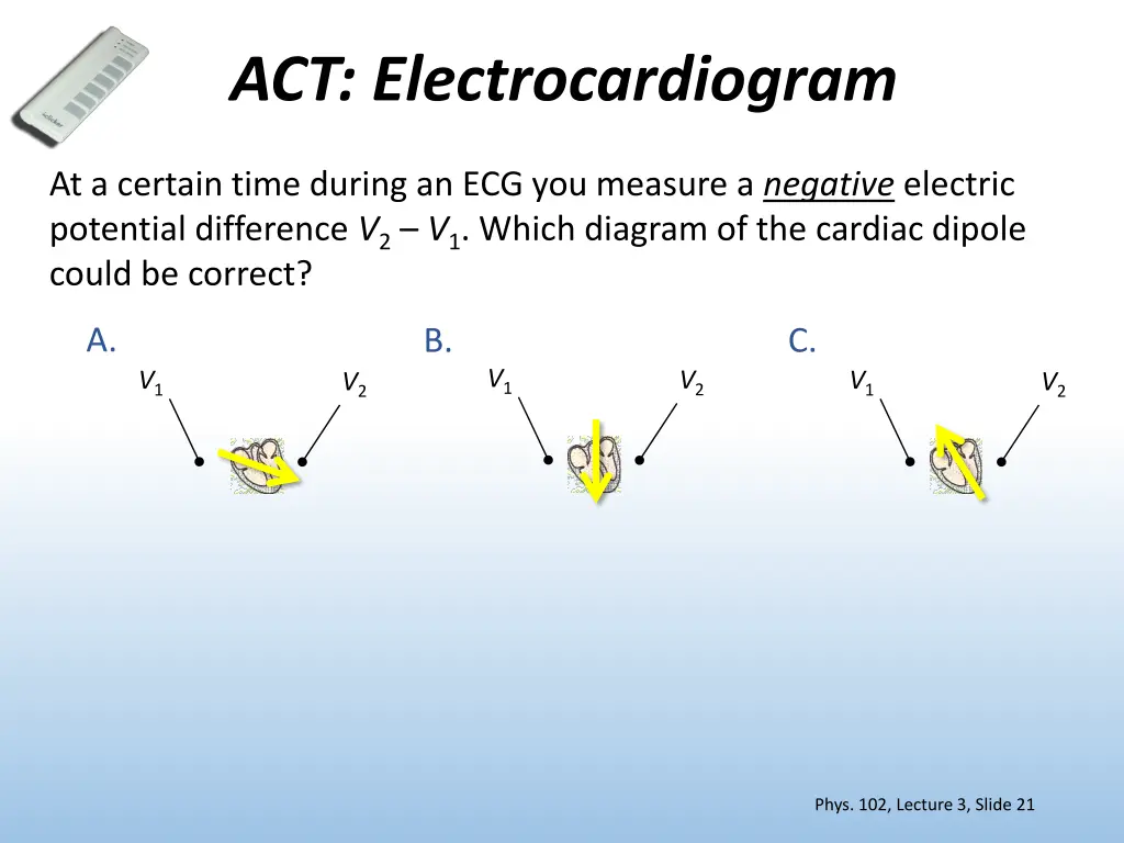 act electrocardiogram