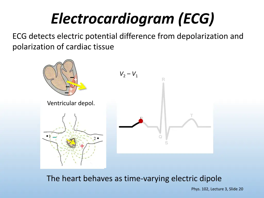 electrocardiogram ecg