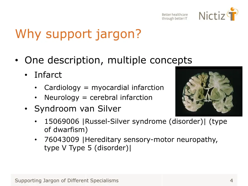 why support jargon