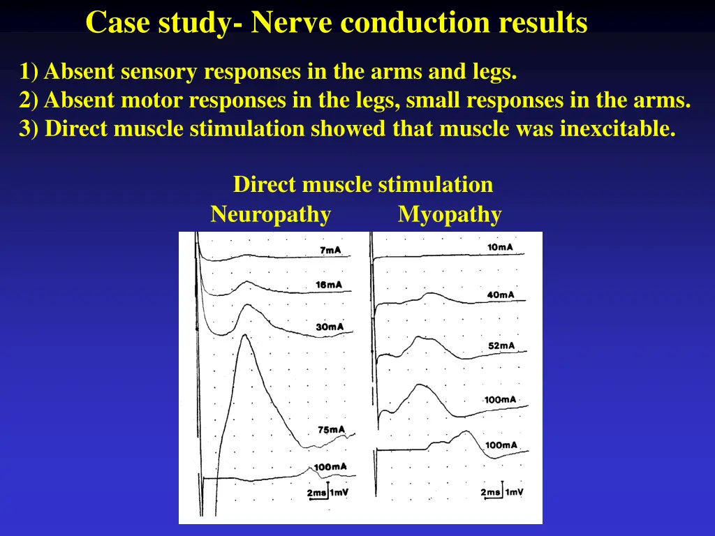 case study nerve conduction results