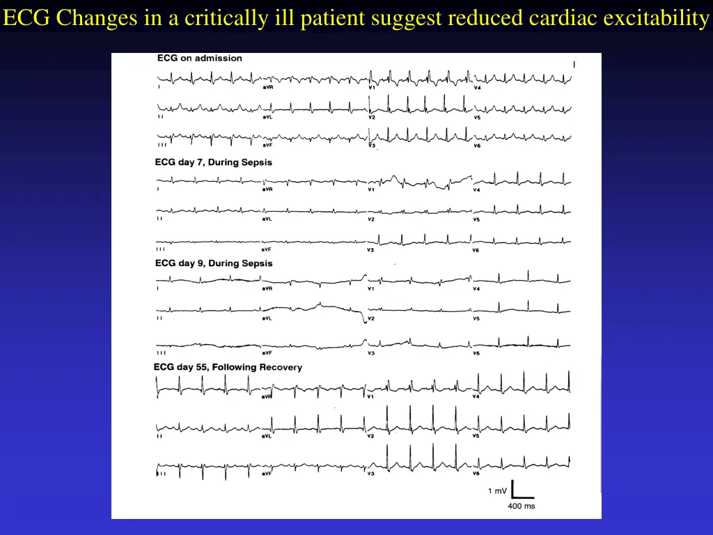 ecg changes in a critically ill patient suggest