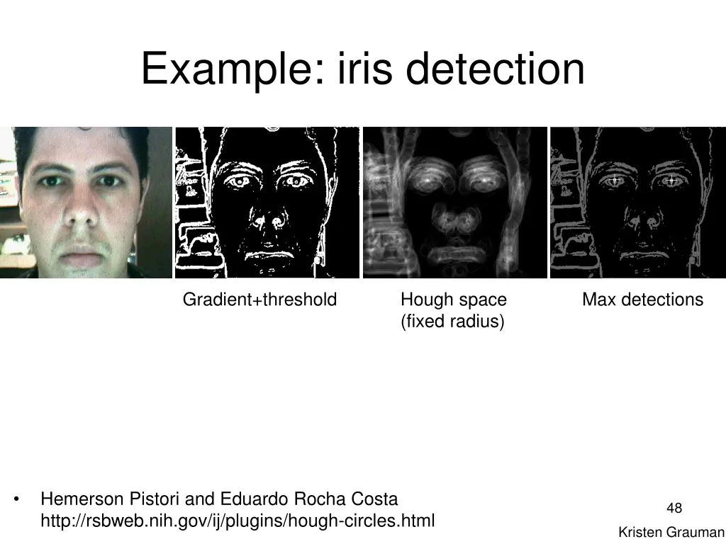 example iris detection