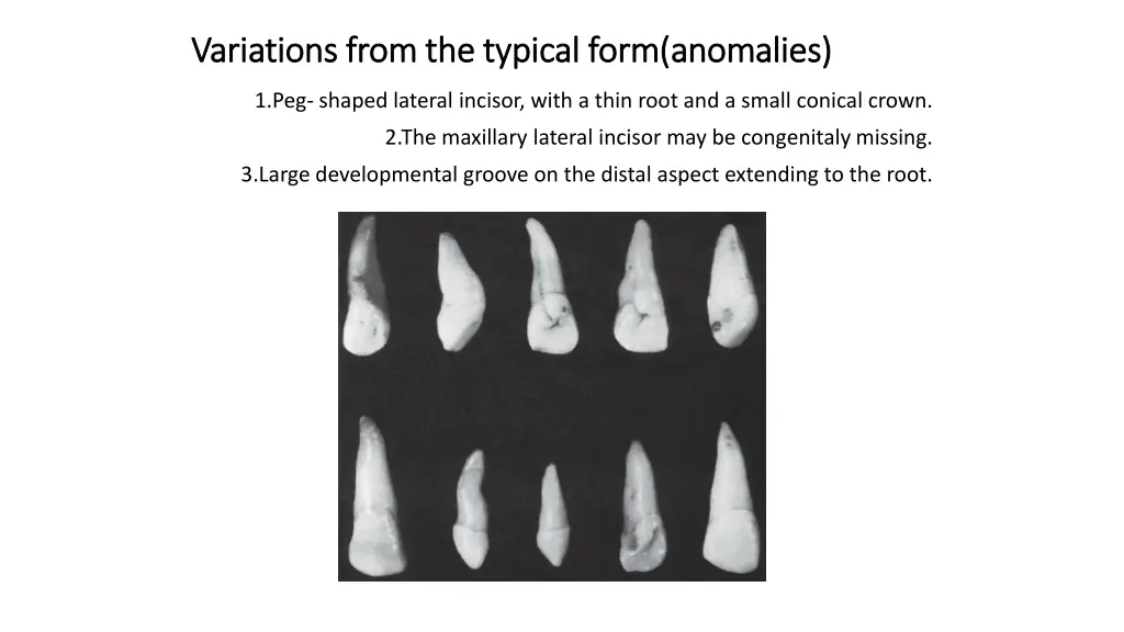 variations from the typical form variations from