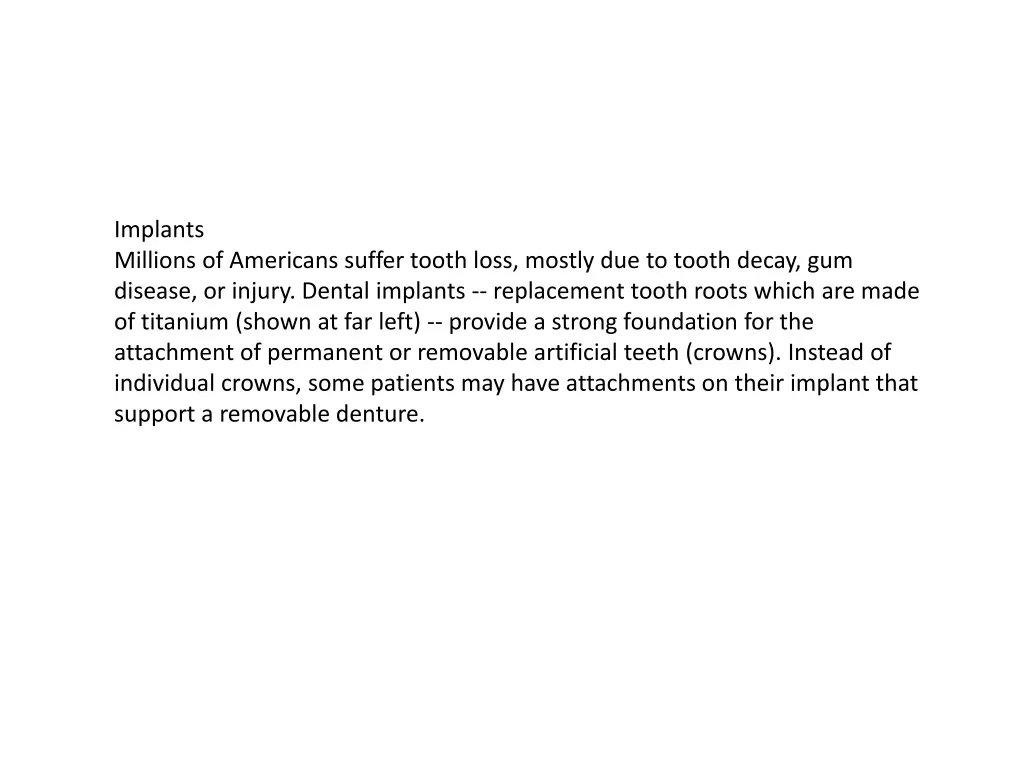 implants millions of americans suffer tooth loss