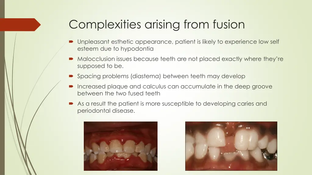 complexities arising from fusion