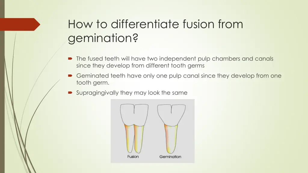 how to differentiate fusion from gemination