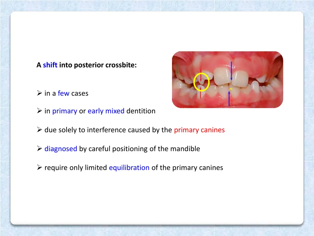 a shift into posterior crossbite