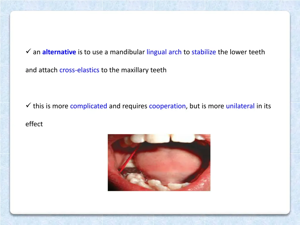 an alternative is to use a mandibular lingual