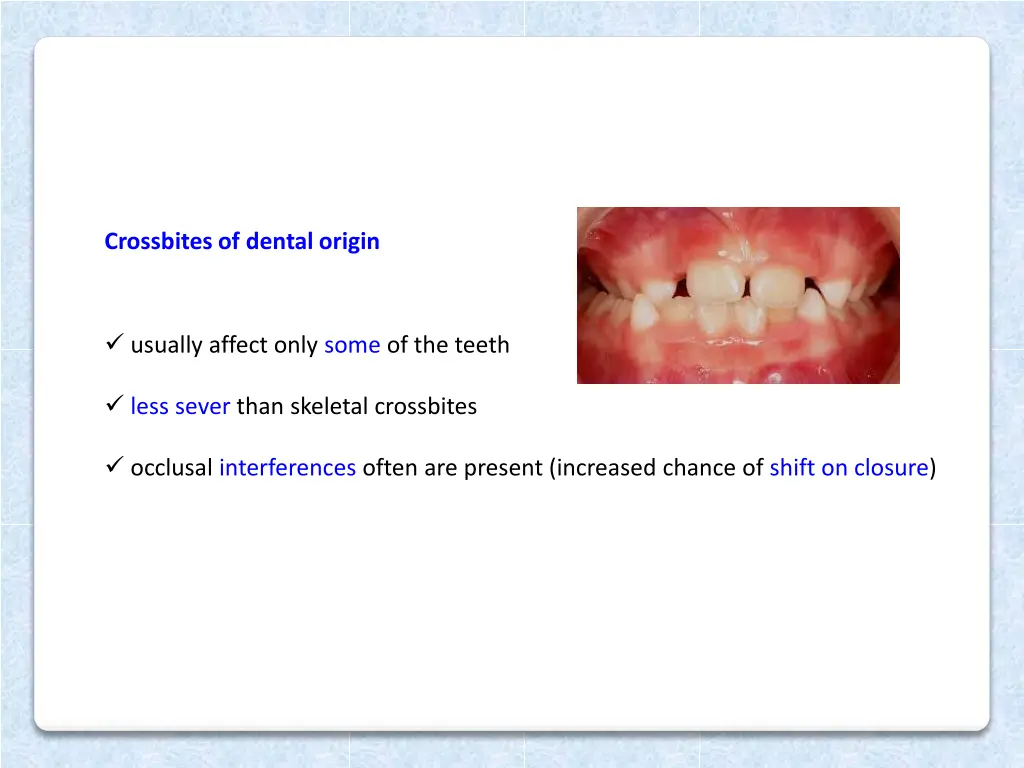 crossbites of dental origin