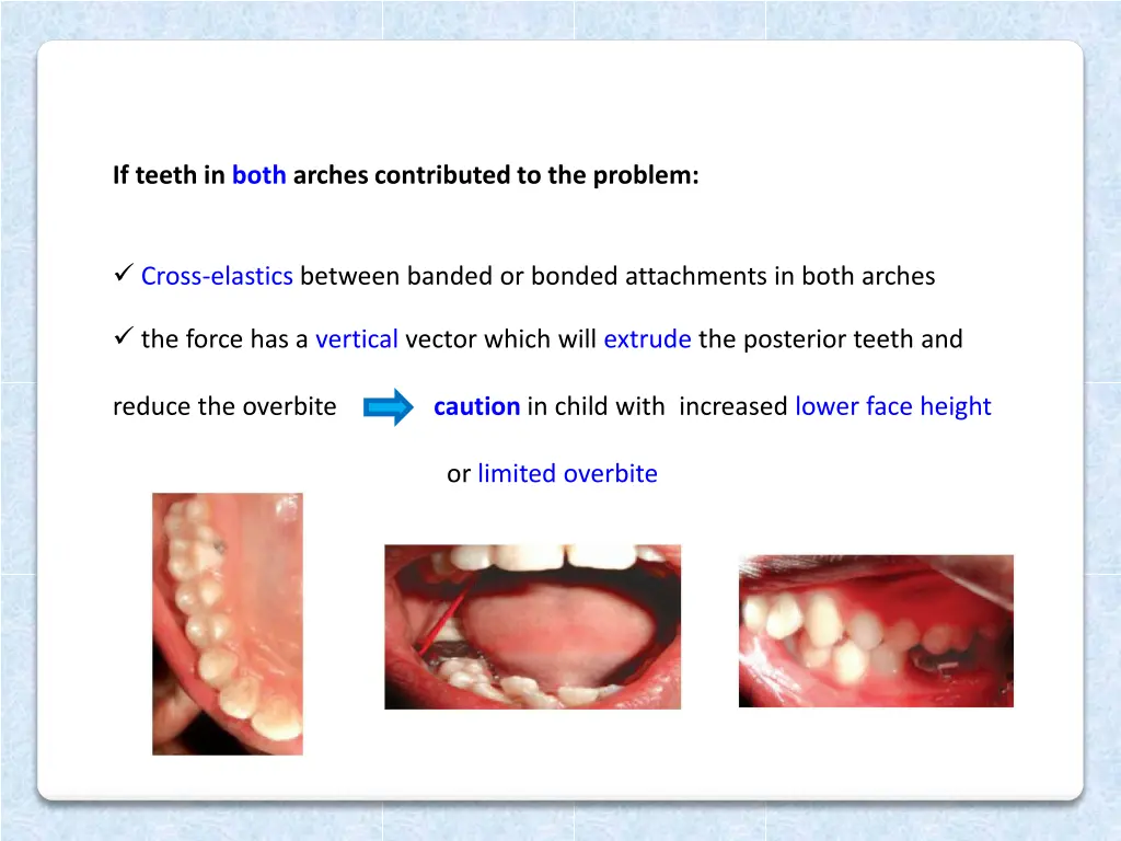 if teeth in both arches contributed to the problem