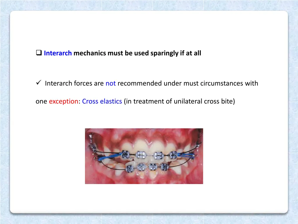 interarch mechanics must be used sparingly