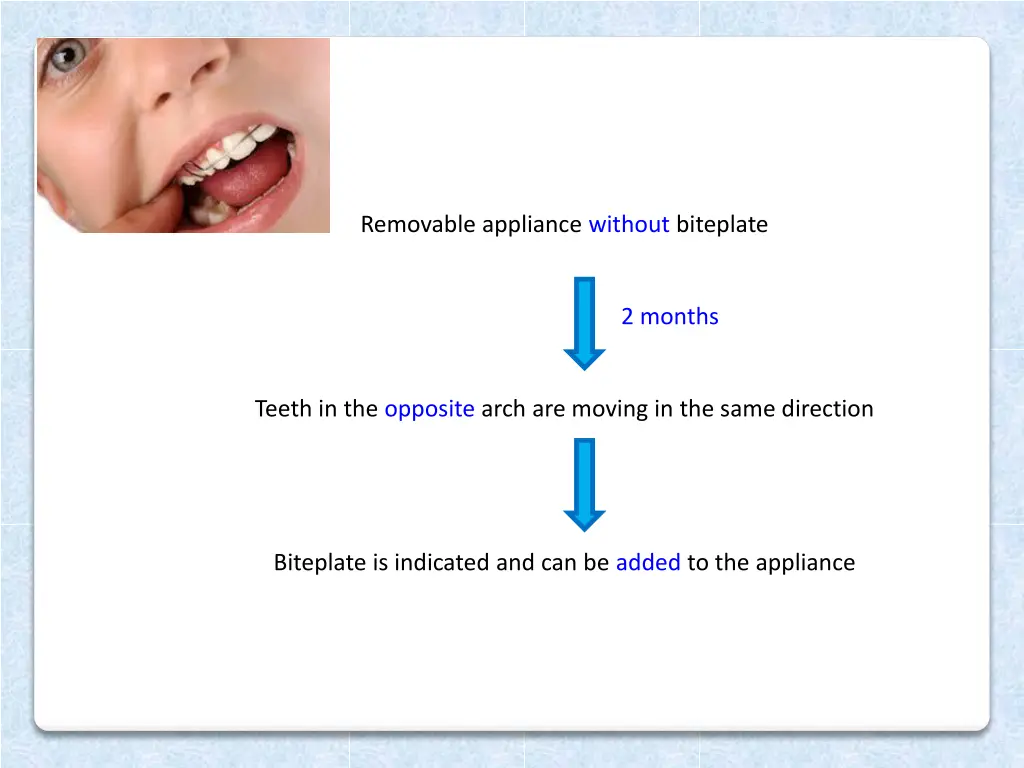 removable appliance without biteplate