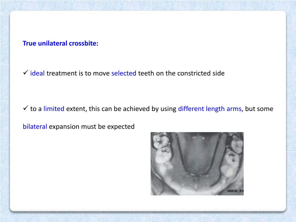 true unilateral crossbite