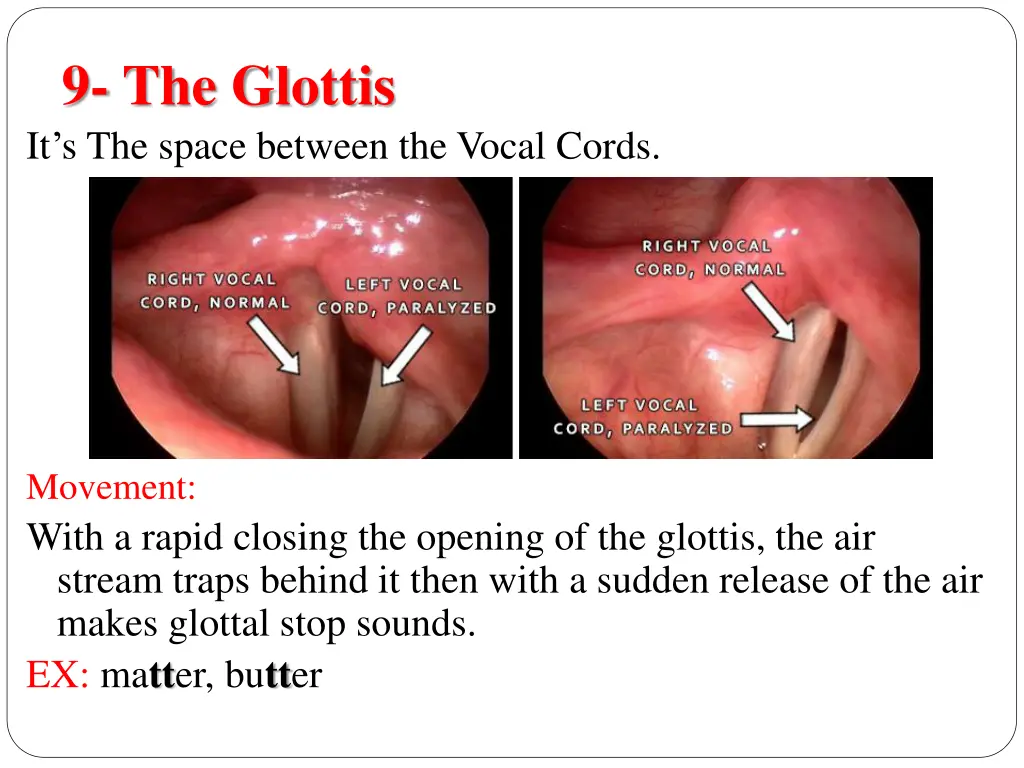 9 the glottis it s the space between the vocal