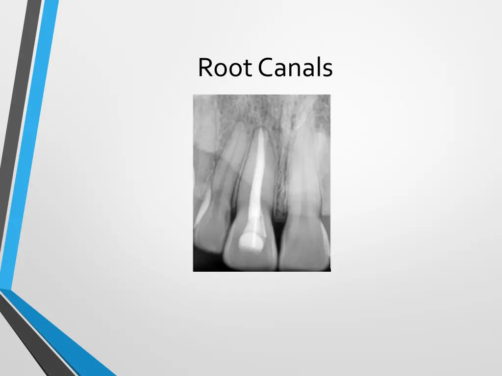 root canals