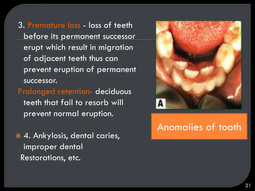 3 premature loss loss of teeth before