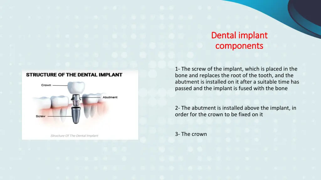 dental implant dental implant components