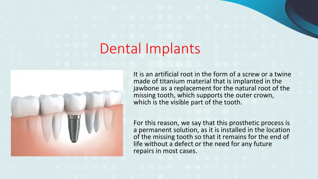 dental implants 1