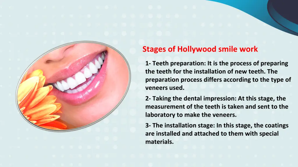 stages of hollywood smile work