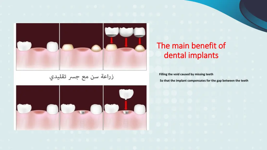 the main benefit of the main benefit of dental