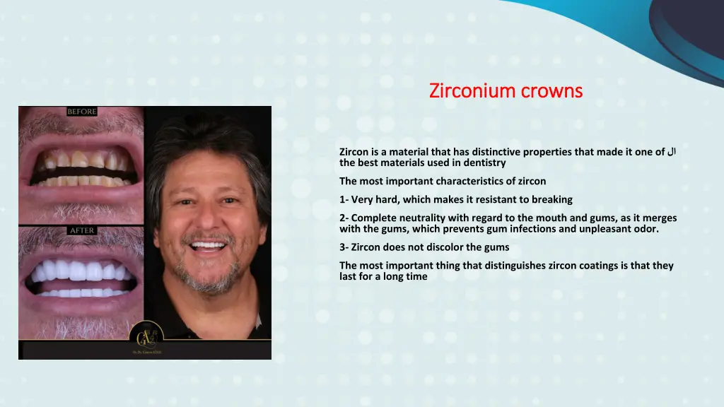 zirconium crowns zirconium crowns