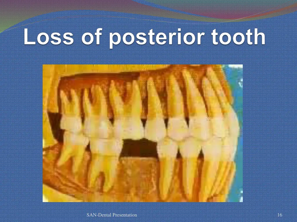 san dental presentation 11