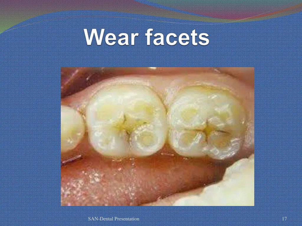 san dental presentation 12