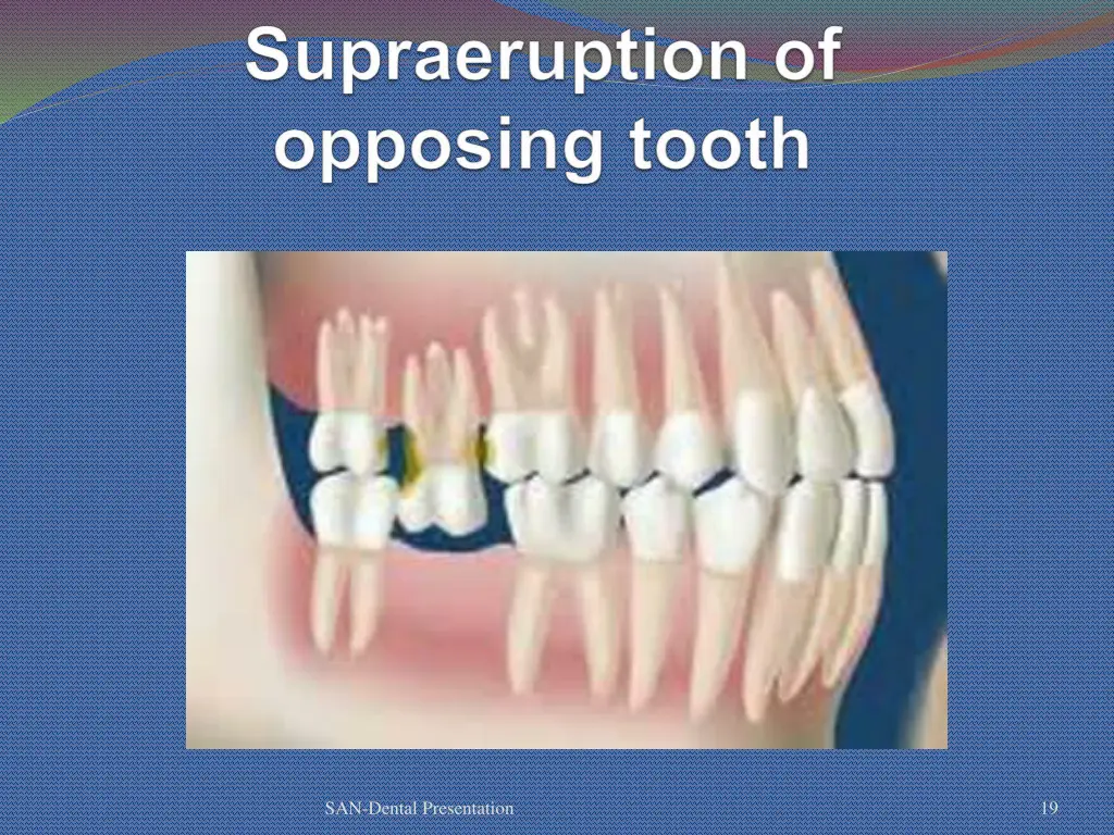 san dental presentation 14