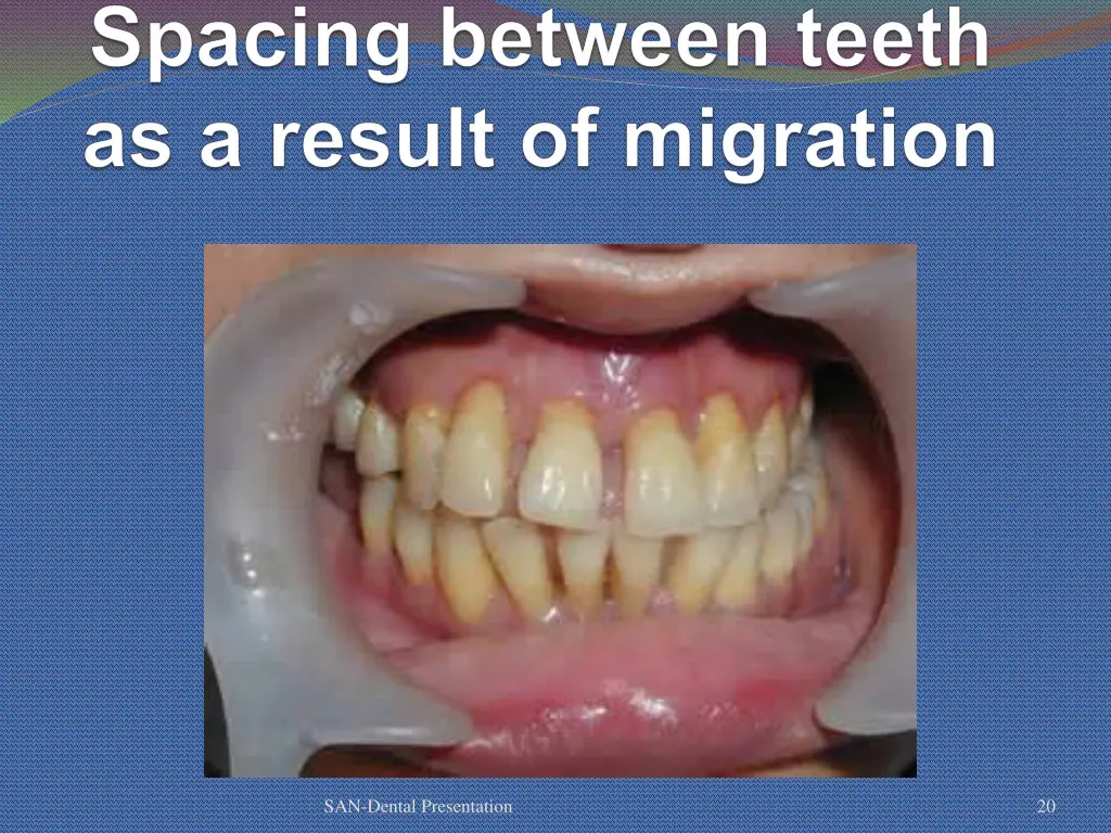 san dental presentation 15