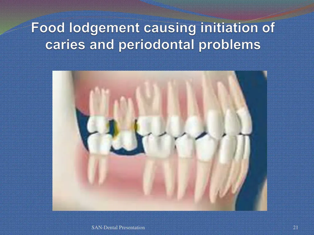 san dental presentation 16