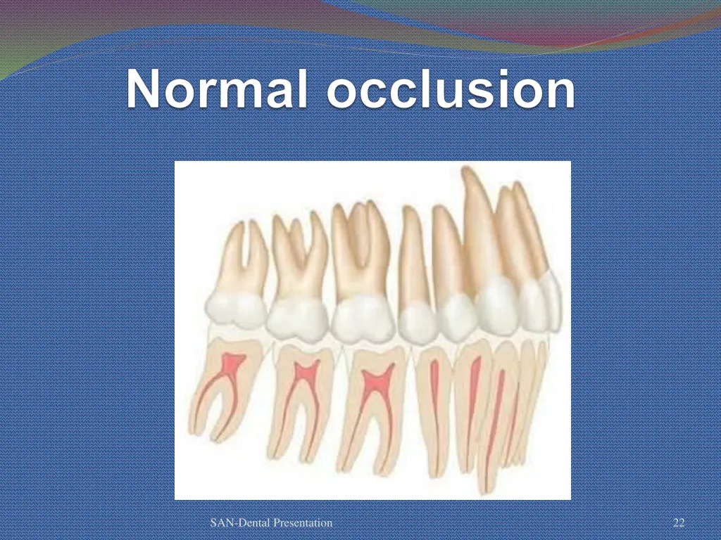 san dental presentation 17