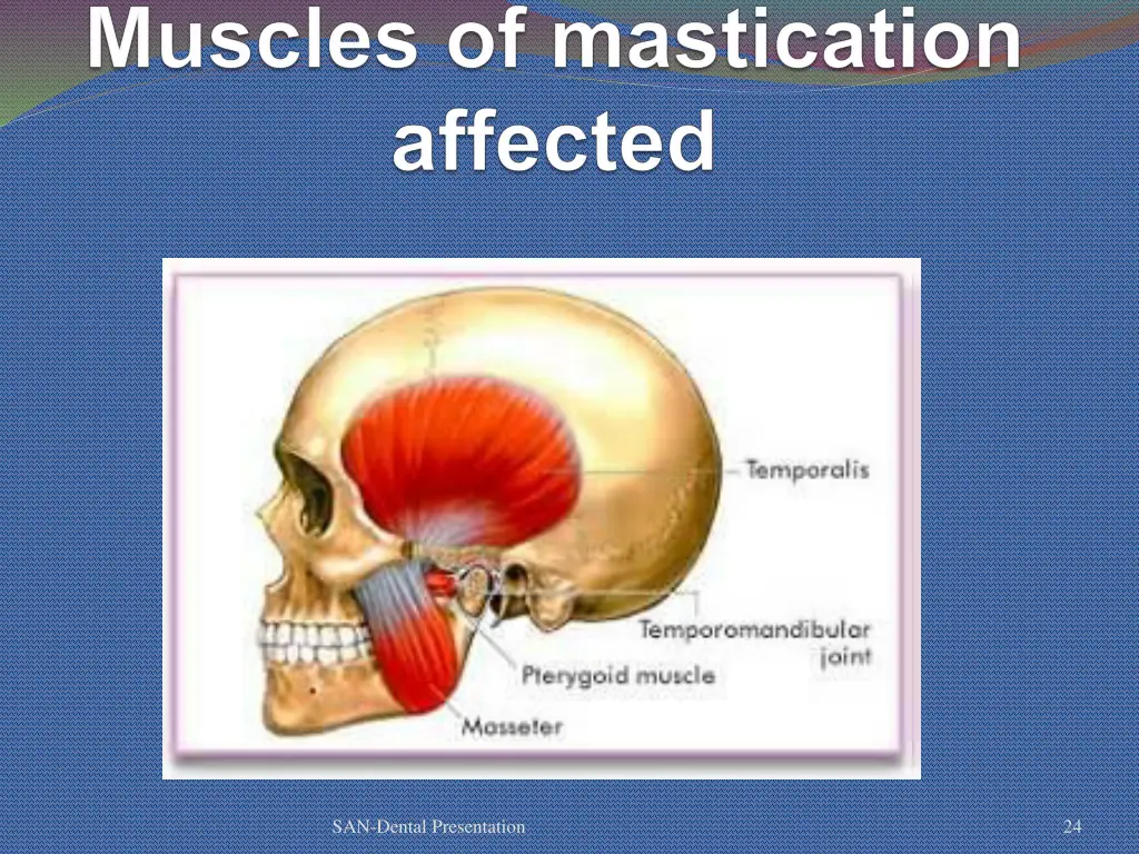 san dental presentation 19